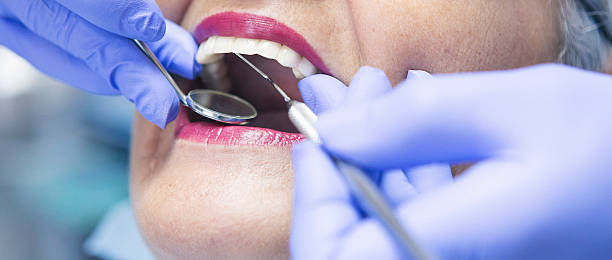 Best Walk-In Emergency Dental Services in Fruitridge Pocket, CA